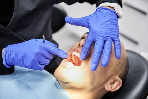 Best Teeth Whitening  in Charleston, IL