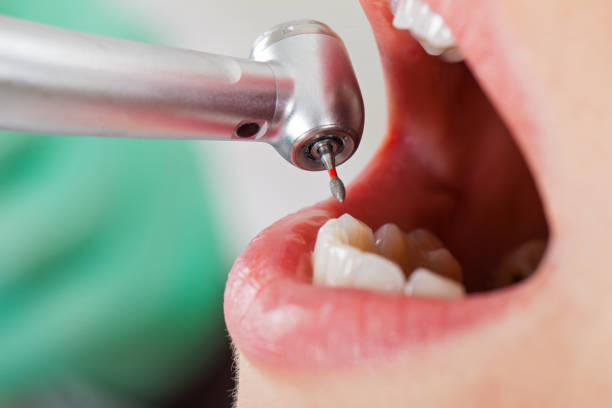 Best Knocked-Out Tooth Emergency  in Charleston, IL